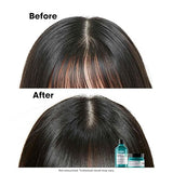 L’Oréal Professionnel Scalp Advanced Anti-Oiliness Dermo-Purifier Shampoo 300ml