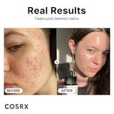 Cosrx Niacinamide 15% Face Serum 20ml | Minimizing Pores & Sebums | Blemish Treatments for Discoloration | Dark Spots | Enlarged Pores | Artificial Fragrance-Free | Parabens-Free