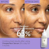 Caudalie Vinoperfect Radiance Dark Spot Serum - Reduces the Appearance of All Types of Dark Spots, Brightens & Evens Skin Tone 30ml